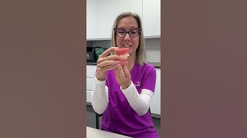 ### Unlock Your Best Smile: Clear Aligners or Braces—Which Will You Choose to Fix Your Overbite? 🌟✨