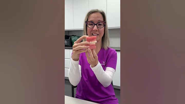 ### Unlock Your Best Smile: Clear Aligners or Braces—Which Will You Choose to Fix Your Overbite? 🌟✨