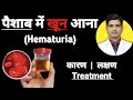 Urine मे ब्लड क्यों आता है इलाज़ | Hematuria in hindi | Hematuria