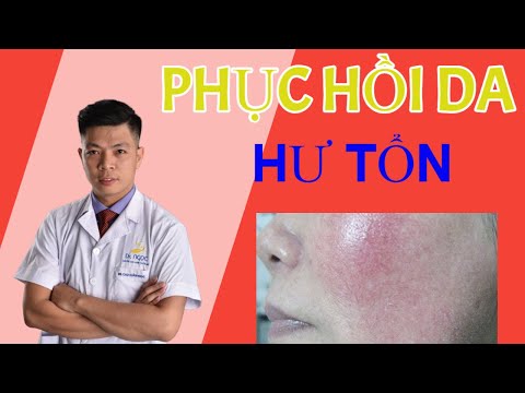 Video PHƯƠNG PHÁP PHỤC HỒI DA HƯ TỔN: GIÃN MẠCH, NHẠY CẢM DO... - youtube