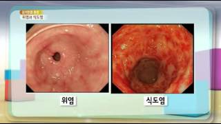 무엇이든 물어보세요 - Ask Anything 20140227 # 001