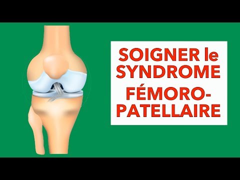 Douleur au genou : soigner le syndrome fémoro-patellaire