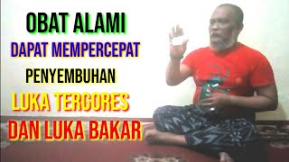 Obat alami dapat mempercepat penyembuhan luka tergores dan luka bakar