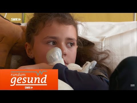 Video: Bindegewebsdysplasie Bei Kindern