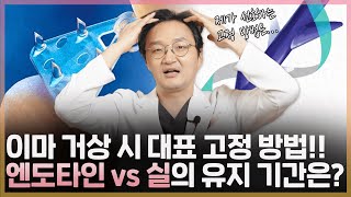 이마 처짐 개선을 위한 이마 거상! 엔도타인ㆍ실 중 어떤 방법이 더 효과적일까?