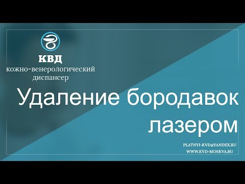298  Удаление бородавок лазером