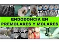 "ENDODONCIA EN PREMOLARES Y MOLARES" por el Dr. Luis Caffo