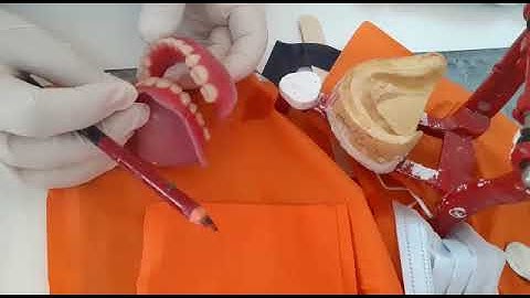 Try in: Centric occlusion - reading articulation paper marks, solutions