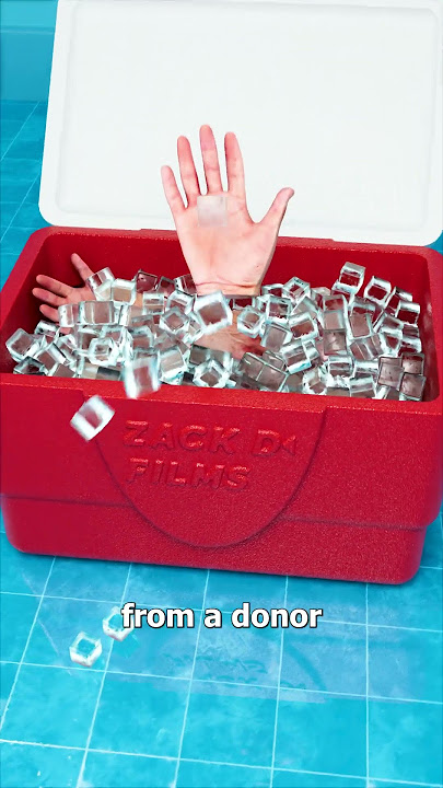 How A Hand Transplant Works ✋
