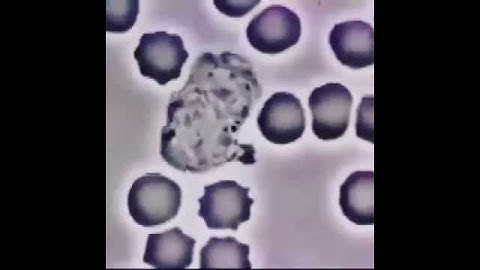 Neutrophil vs. Staphlococcus Aureus bacteria - phagocytosis