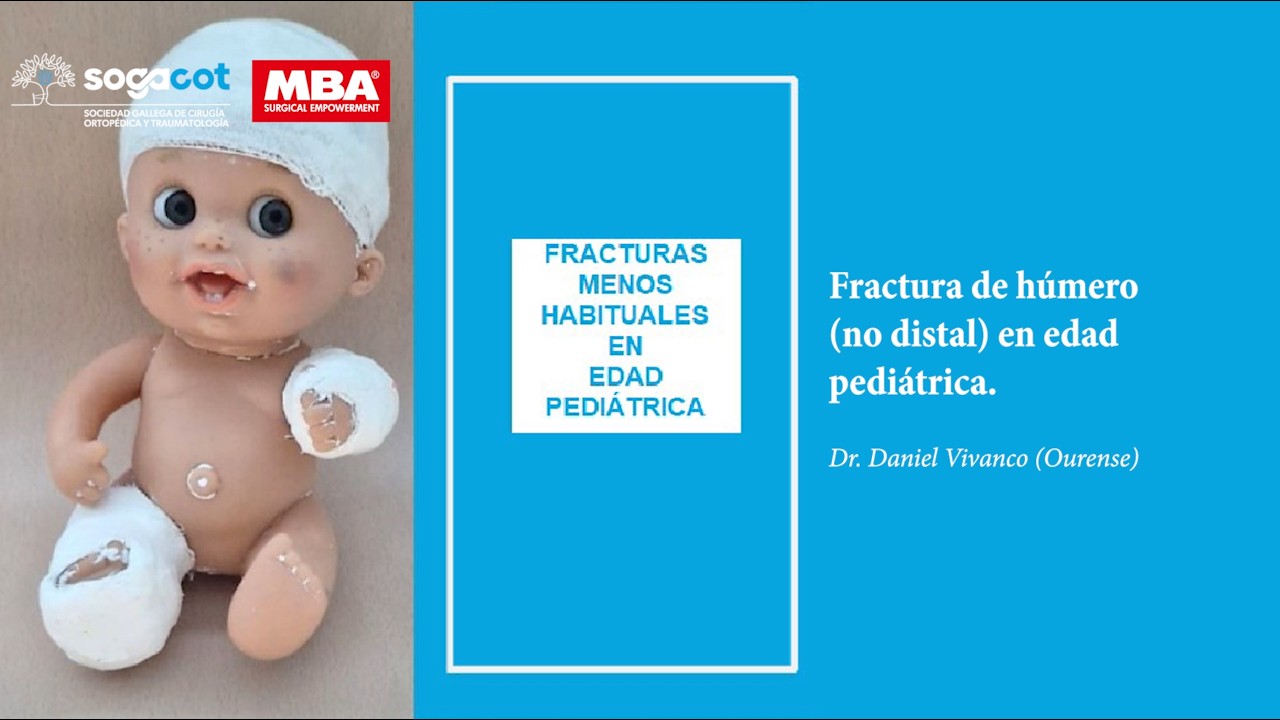 02 - Fracturas de Húmero Proximal y de la Diáfisis Humeral en Edad Pediátrica