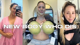 Plastic Surgery Vlog (prices included) Breast Lift and Implants, Chin and Arm Liposuction