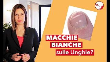 Perché si formano macchie bianche sulle unghie?