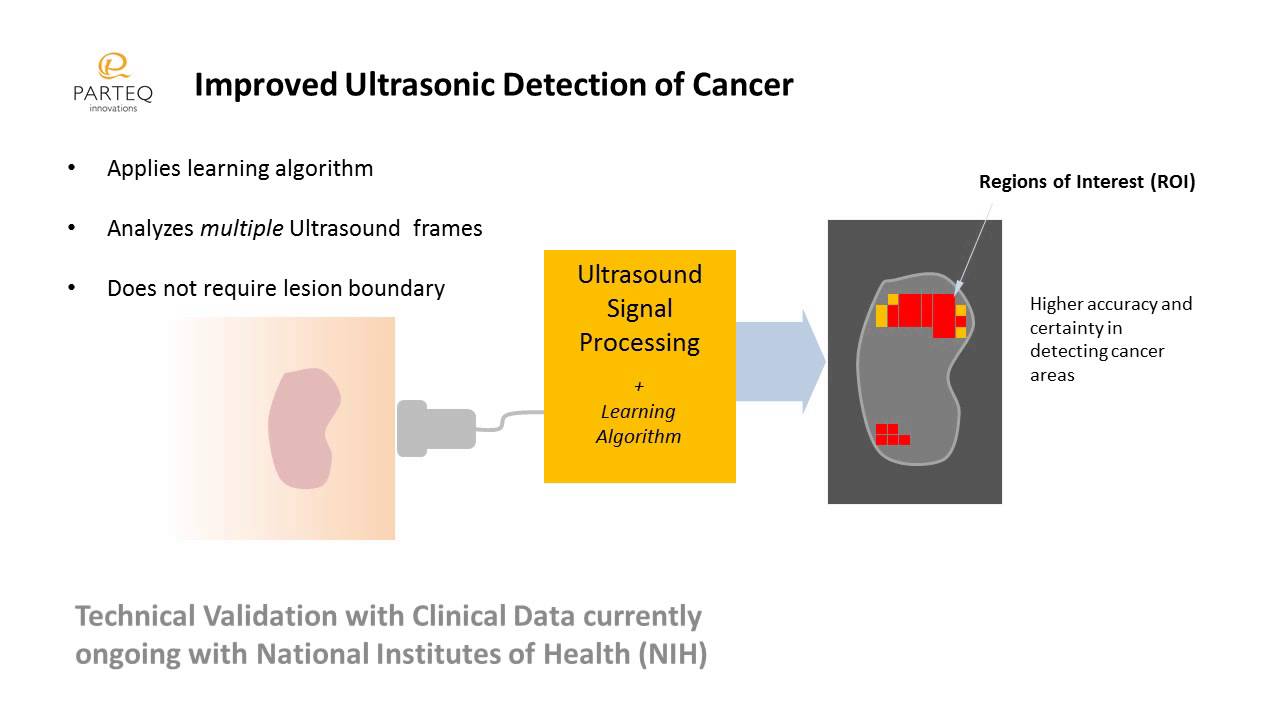 Improved Ultrasonic Detection of Cancer YouTube