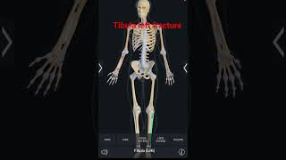 fibula bone anatomy