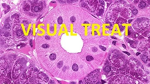 VISUAL TREAT: CELL INJURY(GENERAL PATHOLOGY)