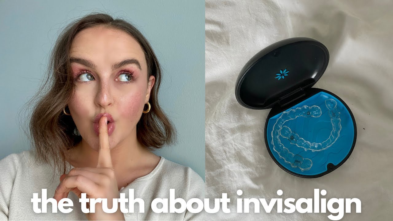 IS INVISALIGN WORTH IT AS AN ADULT? | pain, staining, does invisalign work + more
