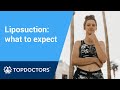 Liposuction: procedure, scars & how much fat can be removed