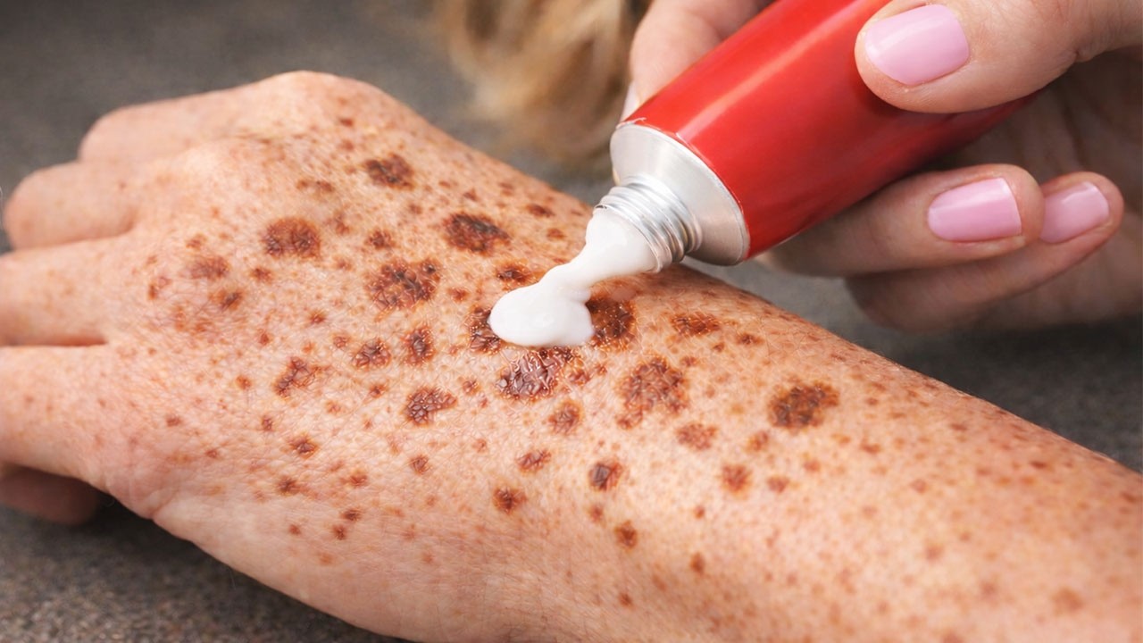 Устраните пигментные пятна, мелазму, солнечные пятна, дефекты кожи и признаки старения.