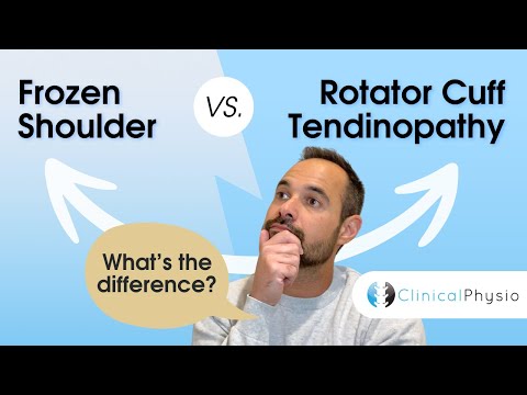 Frozen Shoulder vs. Rotatorenmanschetten-Tendinopathie | Physiotherapeut erklärt den wichtigsten ...