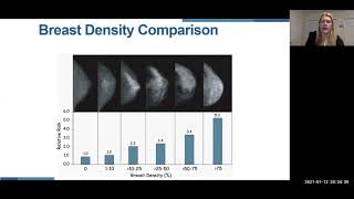 The impact of breast tissue density on the diagnosis of breast cancer