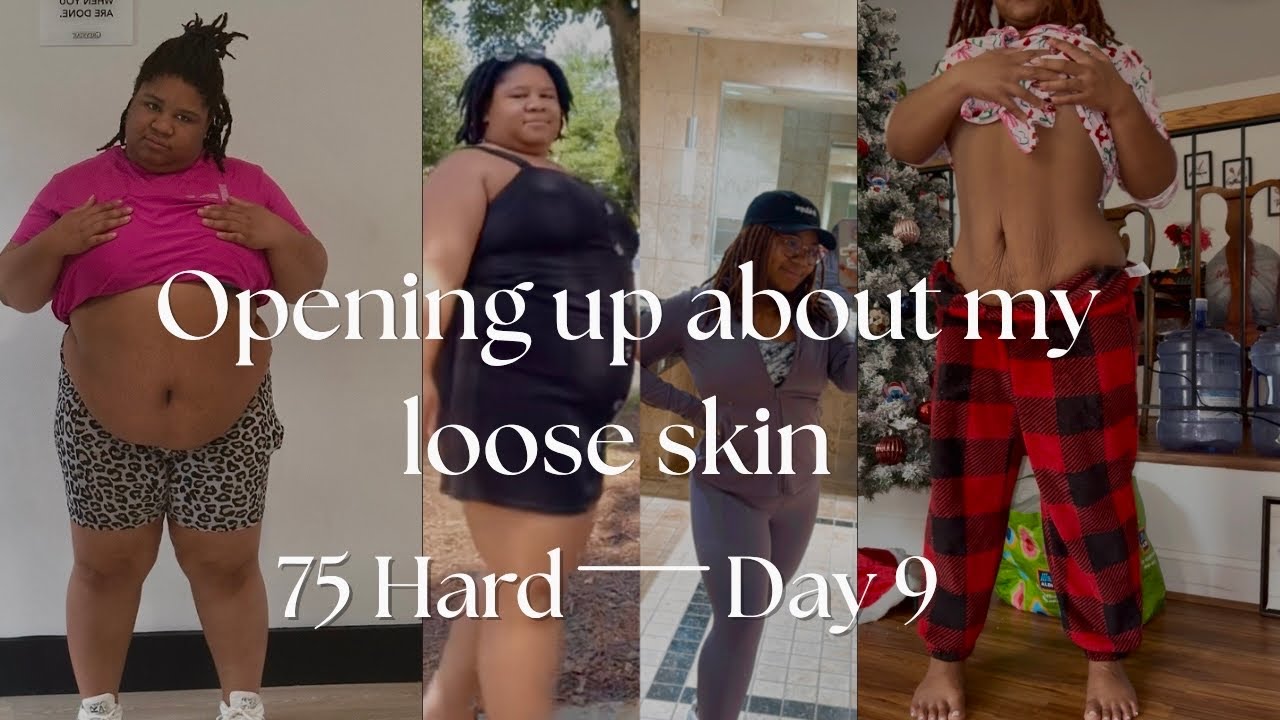 They Don’t Show This Part of 75 Hard… 👀 Loose Skin + Real Progress!