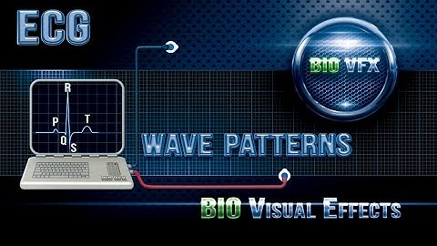 (ECG or EKG) Wave patterns. Part 2
