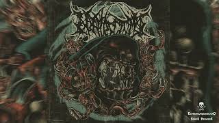 ➤ NEPHRECTOMY - Cirrhotic Bloat-☠(𝐓𝐑𝐀𝐂𝐊 𝐏𝐑𝐄𝐌𝐈𝐄𝐑𝐄 𝟐𝟎𝟐𝟒)☠