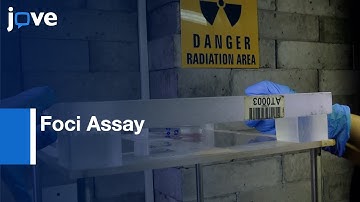 Microscopic Scoring Method for Foci Assay in Blood Lymphocytes | Protocol Preview