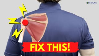 How to Fix Shoulder Snapping and Pop Sounds (NO EQUIPMENT!)