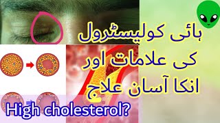 what is hypercholesterolemia/hyperlipidemia/How to control cholesterol level at home@Arslansyed1.0