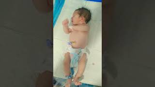 Neonatal Seizures Baby With Fits Signs, Causes & Care