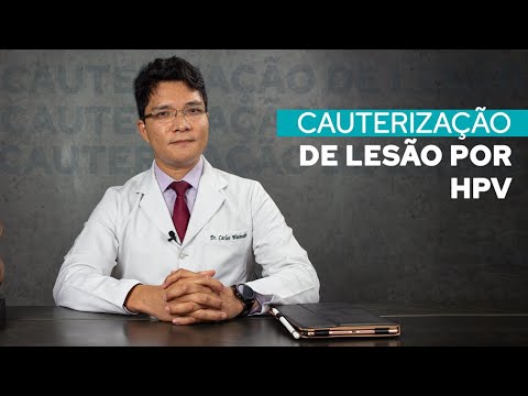 Cauterização de lesão por HPV - Entenda sobre o tratamento e fatores de risco