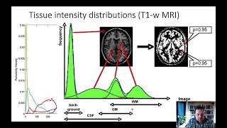 Methods_L3_2_UnifiedSegmentation