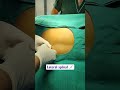 My first lateral spinal ✨ #anesthesia #satisfying #doctorlife