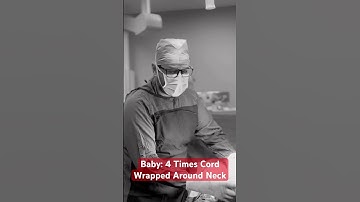 Miracle Baby: Born with Umbilical Cord Wrapped 4 Times