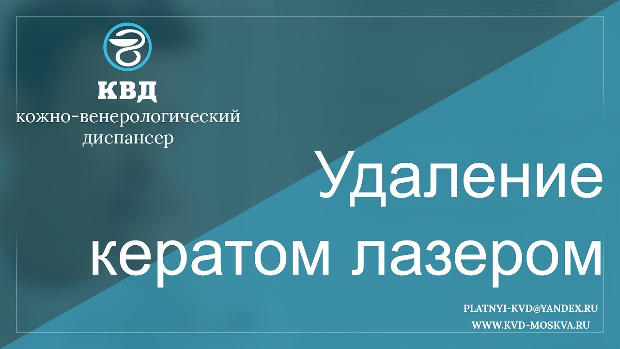 263 Удаление кератом лазером