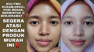 8 REKOMENDASI TERBAIK.!!! Serum Wardah Untuk Kulit Berminyak Dan Berjerawat