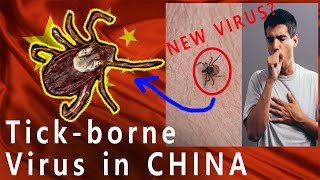 Tick-borne virus in China? (New Virus??)