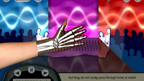 KS3 Electromagnetic Spectrum