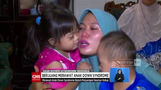 Berjuang Merawat Anak Down Syndrome