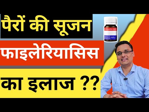 filariasis का इलाज ??? Filariasis symptoms, treatment, explained 