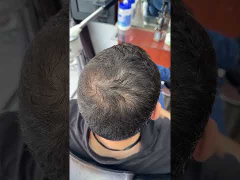 ما تحتاج إلا ثواني وخافي عيوب الشعر يغي ر إطلالتك اطلبه الآن وعيش الفرق