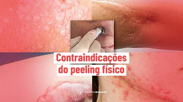 Para que serve o peeling físico?