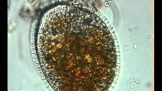 OPHRYOGLENA SP CILIADO CILIATE