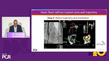 Advanced imaging in structural heart disease interventions - EuroPCR 2025