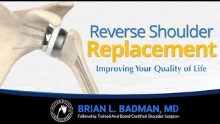 Total Shoulder Replacement - Brian L. Badman, MD