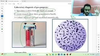 Soft tissue & Skin infections | Microbiology screenshot 4