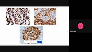 Patterns in Pathology- PART 1 | Postgraduate MD/DNB/DCP | Concept based lecture