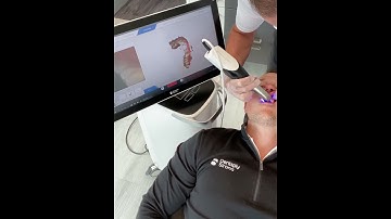 Primescan live scan demo